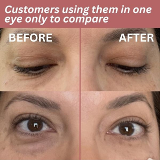 InstantLift Eye Patches