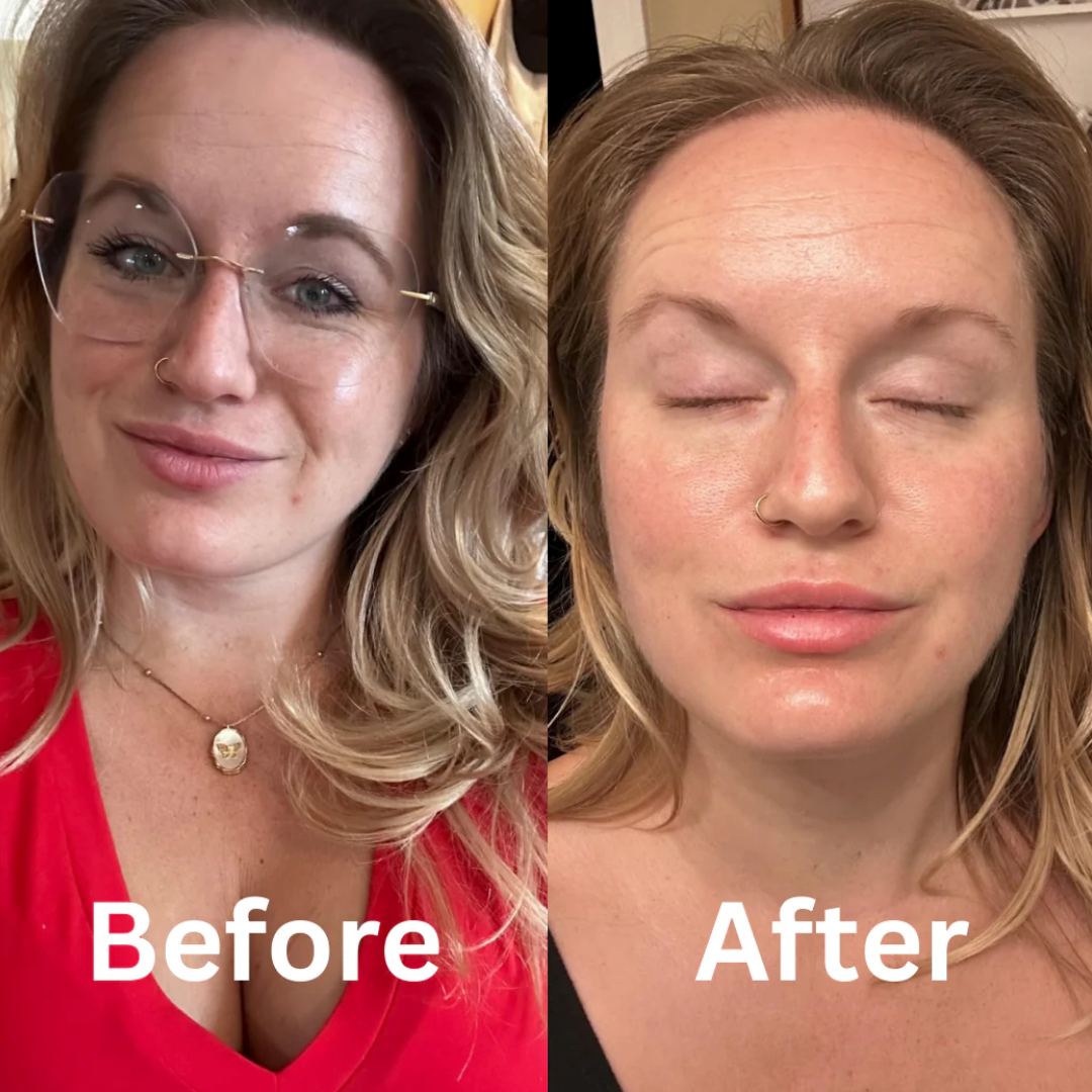 Bio Collagen Mask