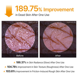 Turmeric Body Peel Shot