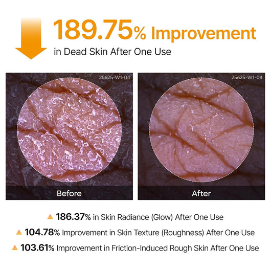 Turmeric Body Peel Shot