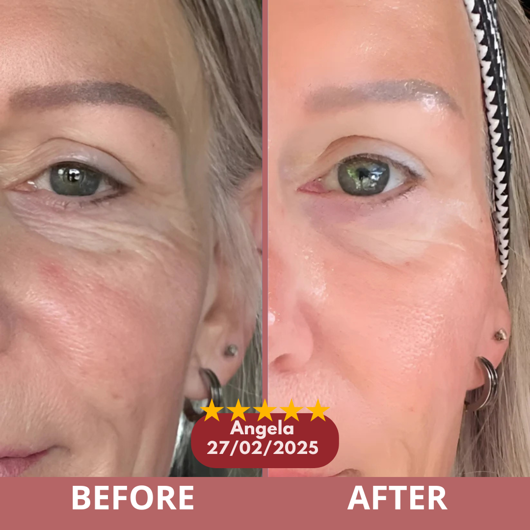 Dermetra Calcium Multi Balm