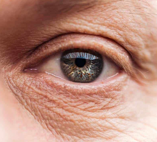 Fine Lines & Wrinkles